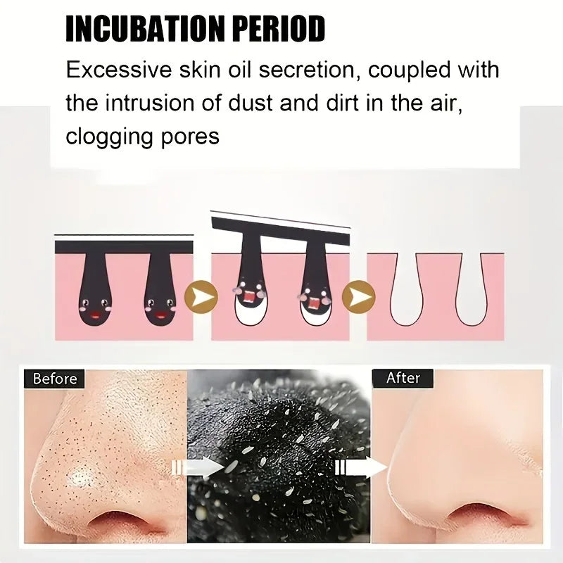 15pcs Deep Cleansing Blackhead Nose Strips – Pore Purifying Stickers for Acne & Oil Control